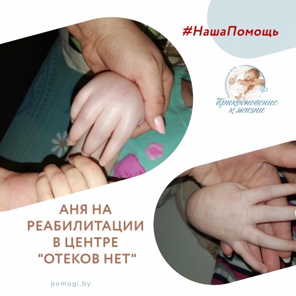 Аня Старовойтова на реабилитации